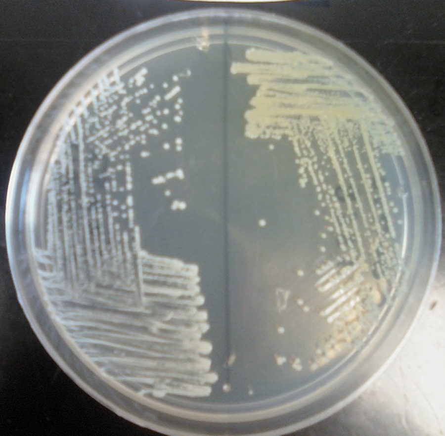 Staphylococcus aureus среда. Стафилококк на желточно солевом агаре. Золотистый стафилококк на ЖСА. Желточно солевой агар микробиология. Колонии стафилококков на ЖСА.